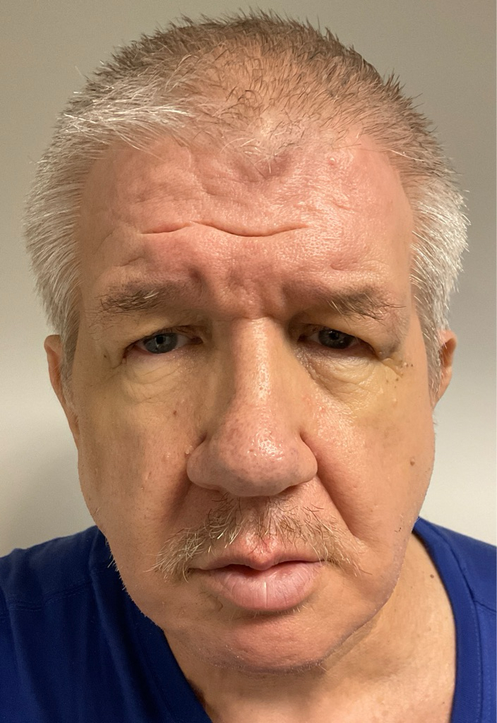 Photo of ROGER LYNN SMITH