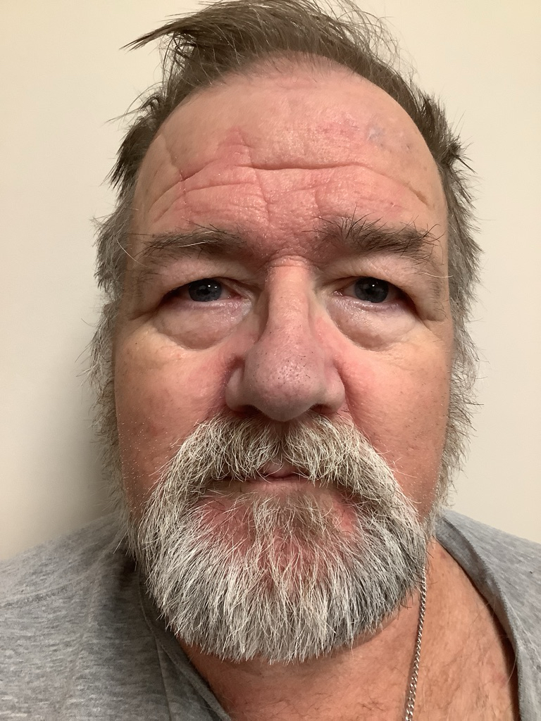 Photo of CARL HUDSON GREENE