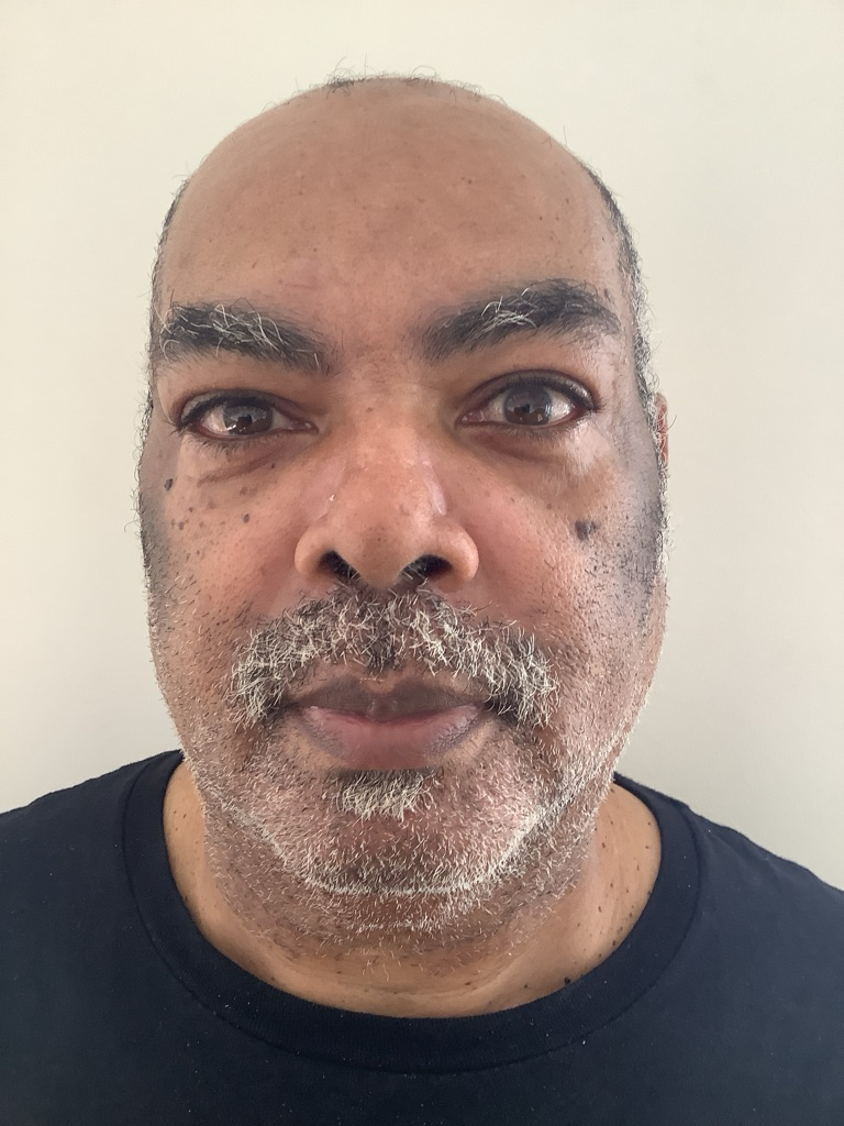 Photo of ORLANDO SEPEDA WALTON