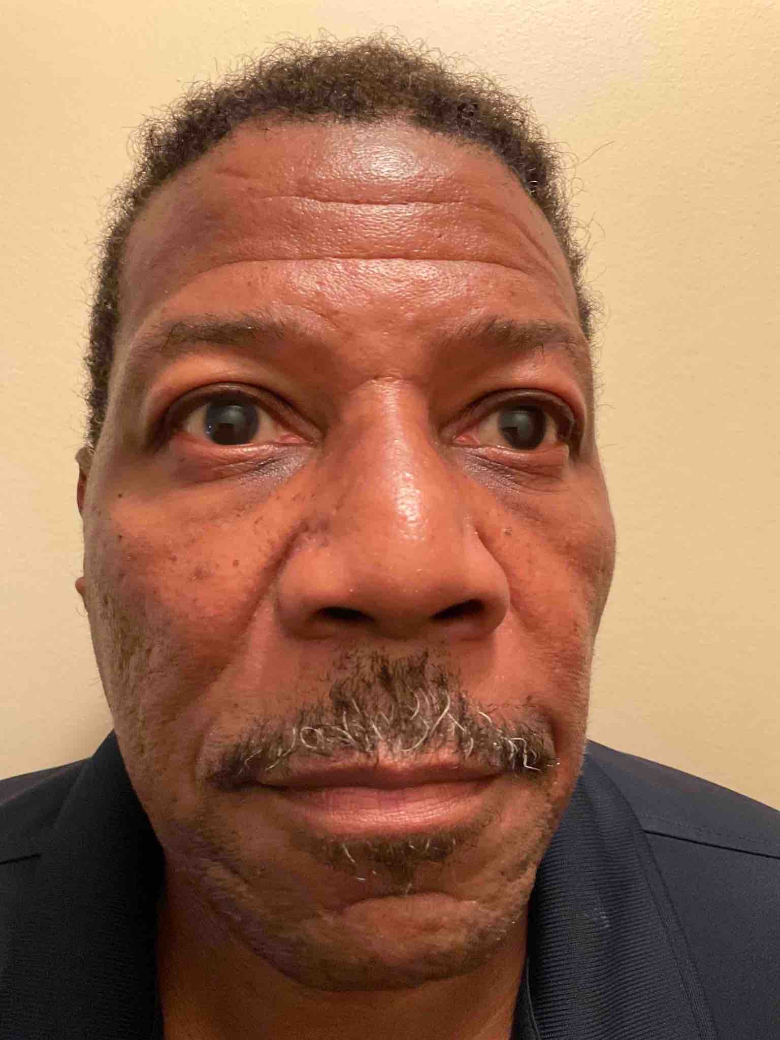 Photo of TONY ROZELLE HOOVER