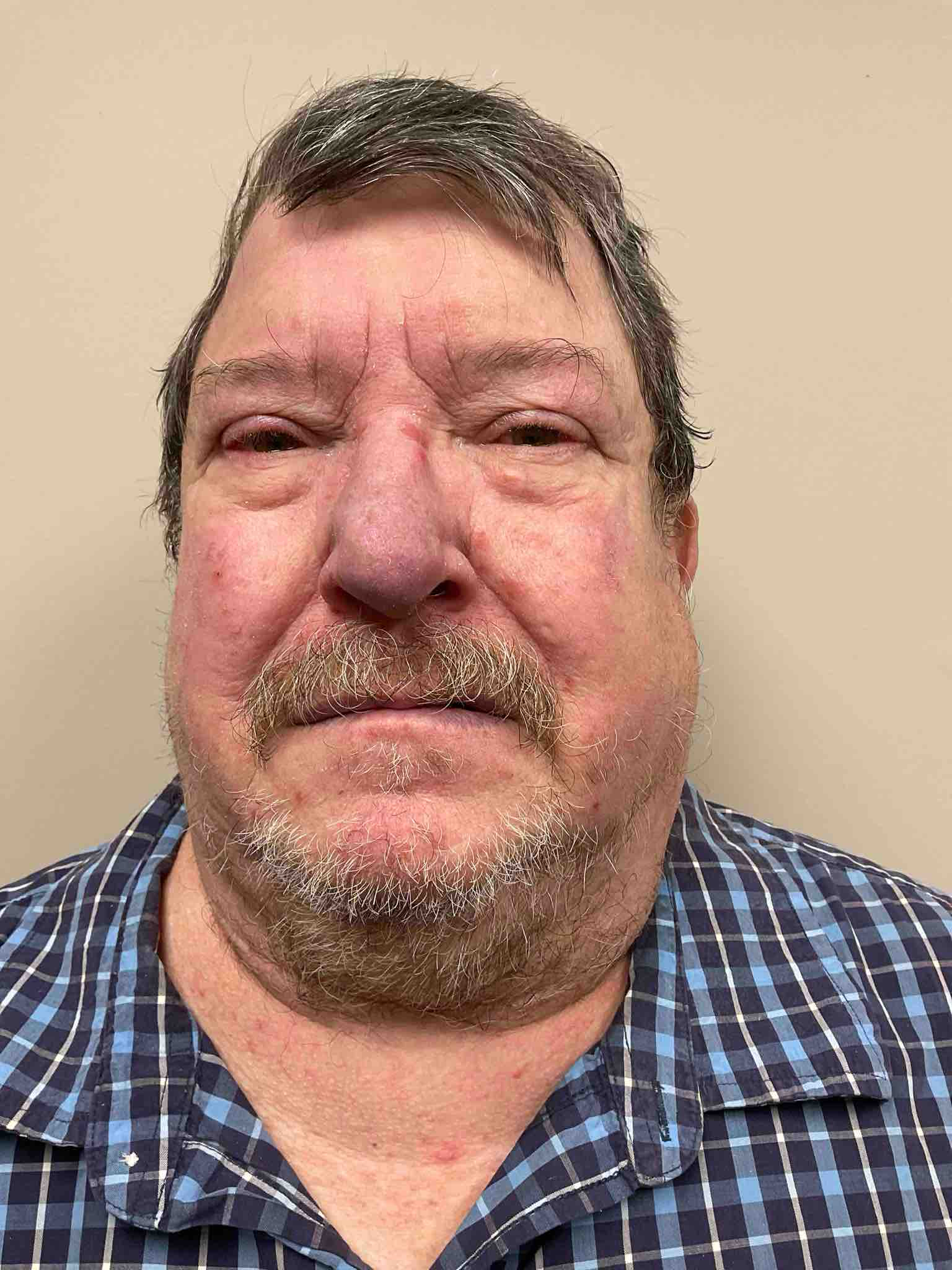 Photo of ROBERT CEPHAS WHITE
