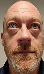 Photo of ALLEN ANTHONY HAMMETT