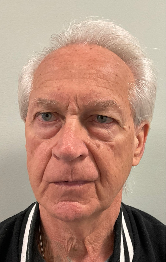 Photo of ANDREW G OPATICK