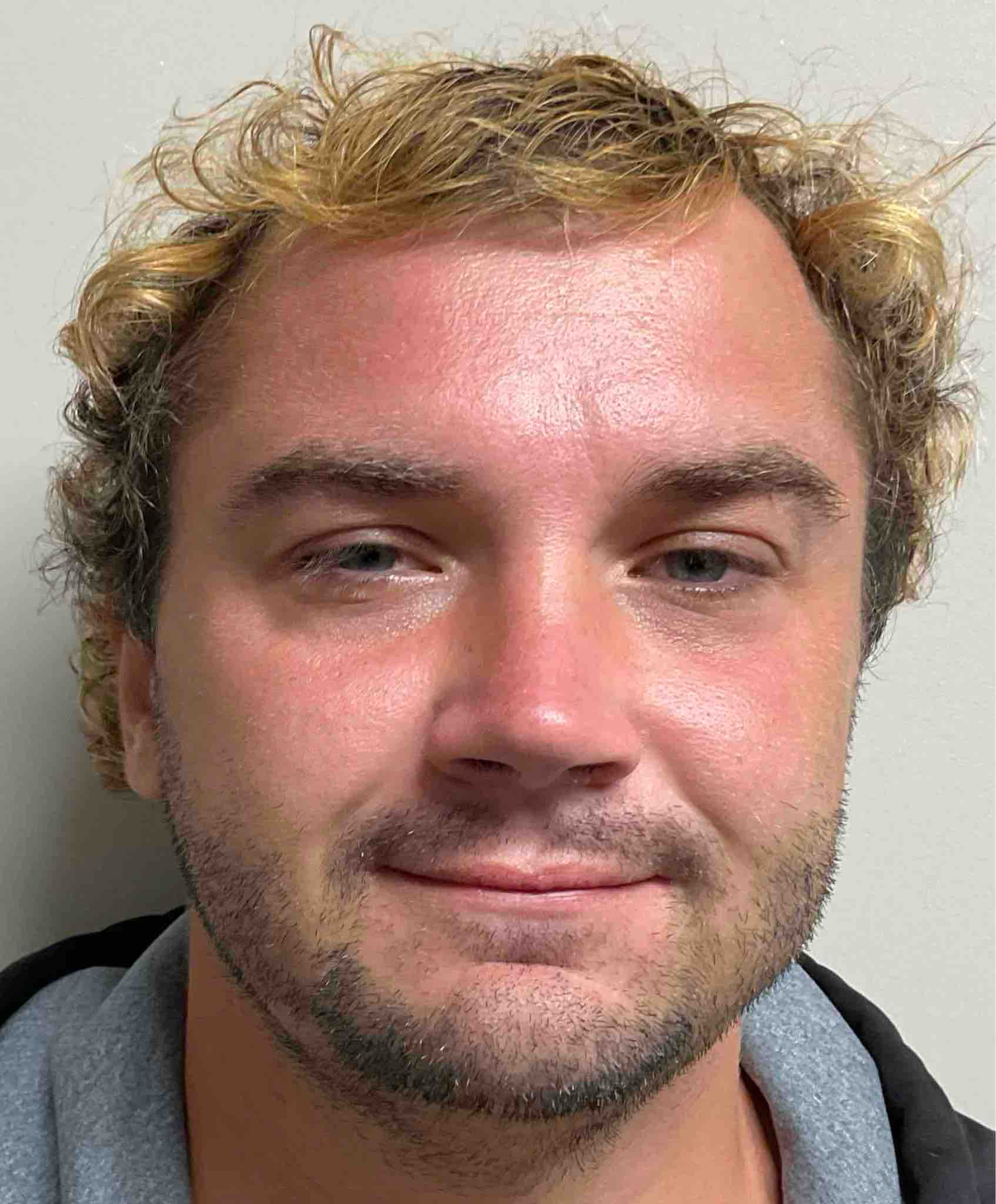 Photo of JAGGER FROGER