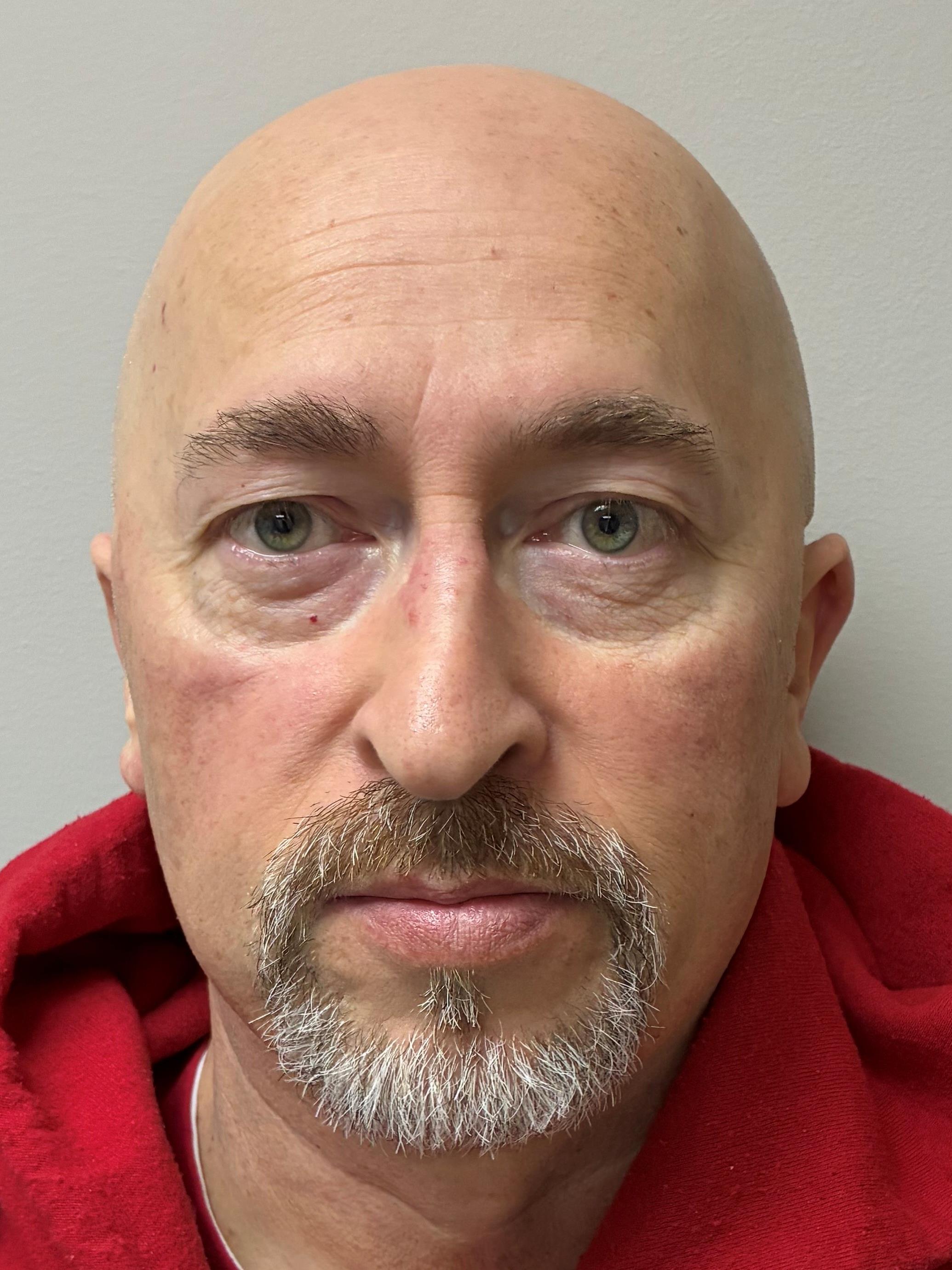 Photo of MICHAEL WAYNE KESTNER